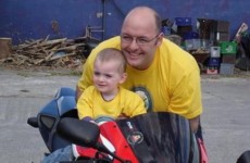 Irish boy, 2, ‘recovering well’ after pioneering brain surgery