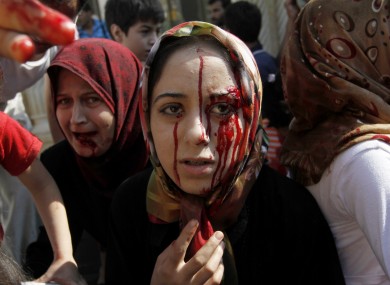 An injured Syrian woman arrives at a field hospital after an air strike hit her home in Azaz on the outskirts of Aleppo on 15 August.