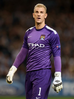 Joe Hart will need to improve on his midweek performance.